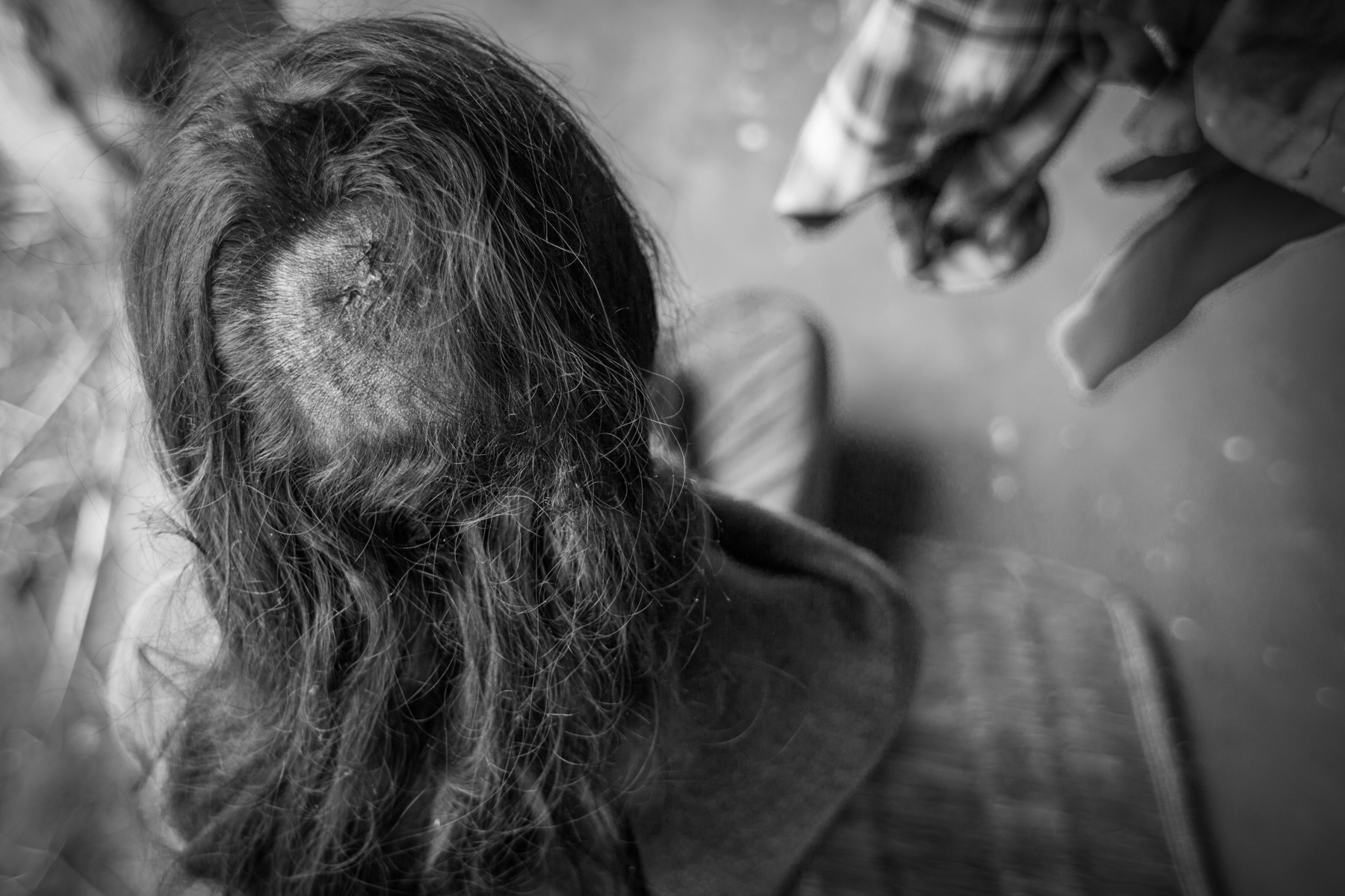 Pampha Magriti, 30, a Dalit woman, was severely beaten when she tried to help Chanamati Maggrati during the attack. 17 December 2013, Dhading, Nepal.